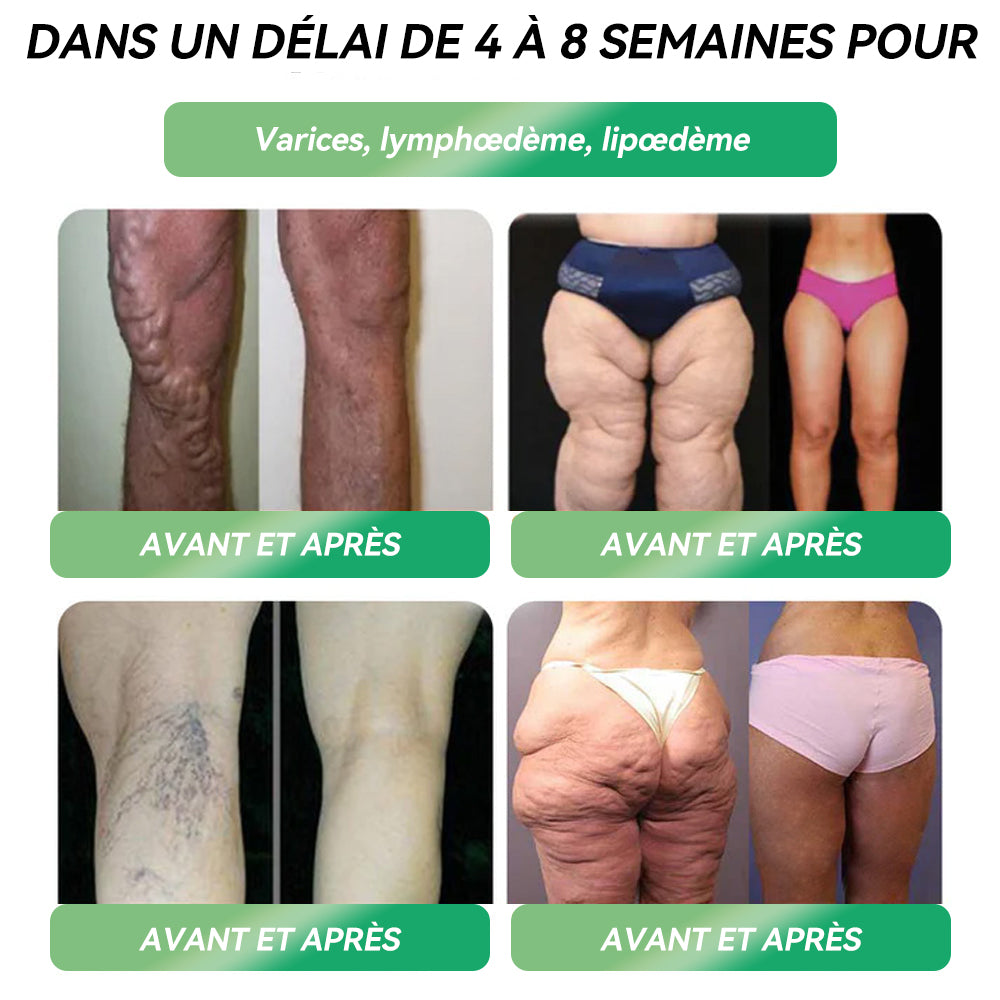 Boutique Officielle👨⚕️𝐋𝐄𝑹𝑪𝐄𝐀® Ampoules Orales Équilibre Métabolique GLP-1💟Obésité, maladies cardiovasculaires, diabète, apnée du sommeil, troubles articulaires et autres affections💟