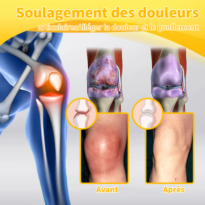 👨‍⚕🔬 Aeehfeng™ Venin d'abeille Crème Avancée pour le Traitement des Articulations et des Os (Spécialisé dans les maladies orthopédiques et les douleurs articulaires)