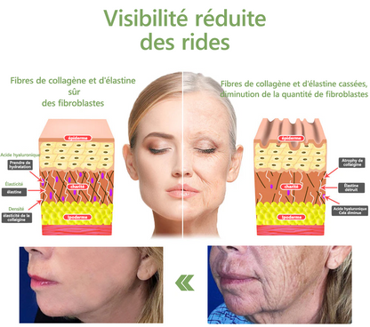 Vente du dernier jour : 70% de réduction sur l'huile raffermissante LEFUN® SkinFirming Rejuvenating Oil💥