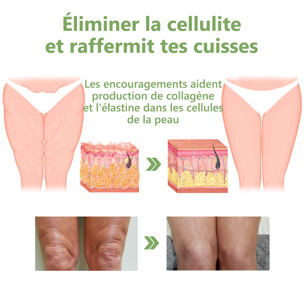 Vente du dernier jour : 70% de réduction sur l'huile raffermissante LEFUN® SkinFirming Rejuvenating Oil💥