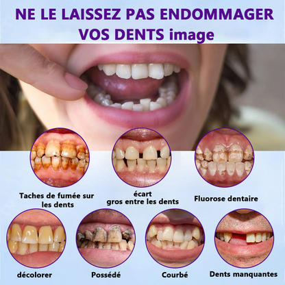 Bikenda™ Ensemble de Règles en Silicone pour Prothèses Dentaires 🚀🚀 (👩‍🔬Conforme CED, Approuvé par des Dentistes Professionnels)