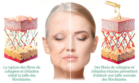 𝐑𝐞𝐜𝐨𝐦𝐦𝐚𝐧𝐝é 𝐩𝐚𝐫 𝐝𝐞𝐬 𝐦é𝐝𝐞𝐜𝐢𝐧𝐬｜✨𝐓𝐋𝐎𝐏𝐀™ 𝐁𝐞𝐚𝐮𝐭𝐲𝐖𝐨𝐦𝐞𝐧 𝐇𝐮𝐢𝐥𝐞 𝐜𝐨𝐫𝐩𝐨𝐫𝐞𝐥𝐥𝐞 𝐥𝐢𝐟𝐭𝐚𝐧𝐭𝐞 𝐚𝐮 𝐜𝐨𝐥𝐥𝐚𝐠è𝐧𝐞 (𝐑é𝐬𝐮𝐥𝐭𝐚𝐭𝐬 𝐯𝐢𝐬𝐢𝐛𝐥𝐞𝐬 𝐞𝐧 𝐬𝐞𝐮𝐥𝐞𝐦𝐞𝐧𝐭 𝟕 𝐣𝐨𝐮𝐫𝐬) 𝐂𝐨𝐧𝐯𝐢𝐞𝐧𝐭 𝐩𝐨𝐮𝐫 : 𝐫𝐞𝐥â𝐜𝐡𝐞𝐦𝐞𝐧𝐭 𝐜𝐮𝐭𝐚𝐧é, 𝐢𝐧𝐟𝐥𝐚𝐦𝐦𝐚𝐭𝐢𝐨𝐧𝐬 𝐝𝐞 𝐥𝐚 𝐩𝐞𝐚𝐮, 𝐯𝐞𝐫𝐫𝐮𝐞𝐬, 𝐯𝐚𝐫𝐢𝐜𝐞𝐬 𝐞𝐭 𝐝𝐢𝐯𝐞𝐫𝐬 𝐩𝐫𝐨𝐛𝐥è𝐦𝐞𝐬 𝐜𝐮𝐭𝐚𝐧é𝐬 🎗️