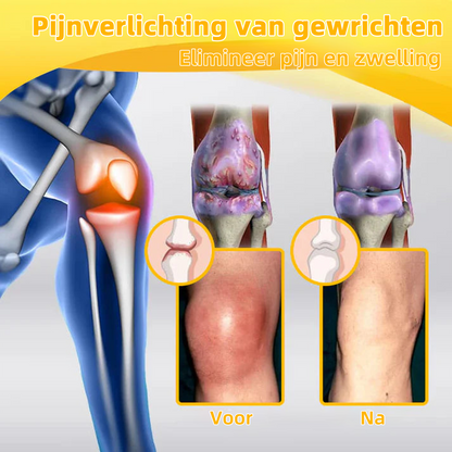 ArthroFree™ Bijen-Gif Pijnstillende Crème (Speciale Geschikt Voor Ouderen En Aanbevolen Door De Nederlandse Orthopedische Vereniging (NOV) 🐮