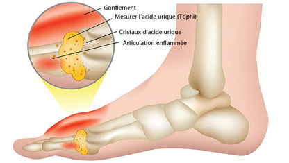 ArthroEase Bee Venom Joint and Bone Arthritis Therapy Cream⭐(Spécialement pour les personnes âgées et recommandé par l'AAOS)