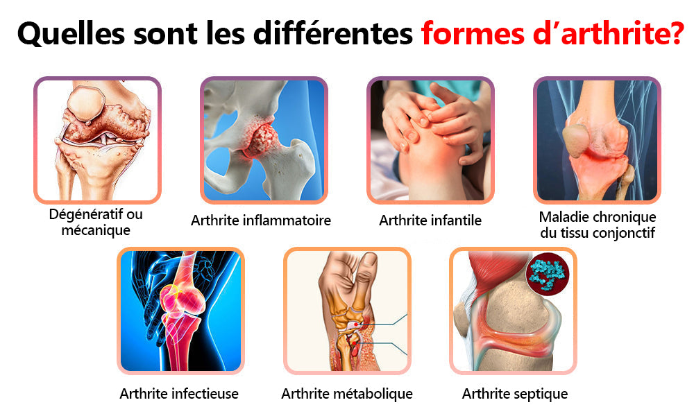 ArthroEase Bee Venom Joint and Bone Arthritis Therapy Cream⭐(Spécialement pour les personnes âgées et recommandé par l'AAOS)