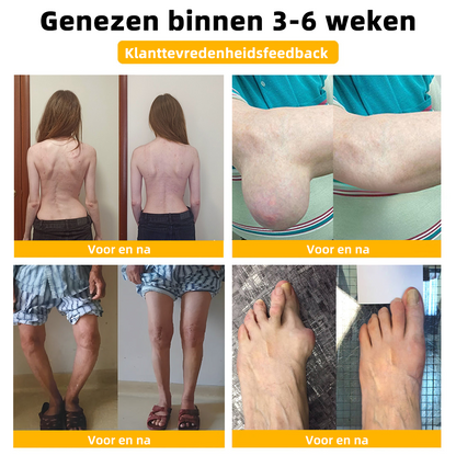 ArthroFree™ Bijen-Gif Pijnstillende Crème (Speciale Geschikt Voor Ouderen En Aanbevolen Door De Nederlandse Orthopedische Vereniging (NOV) 🐮