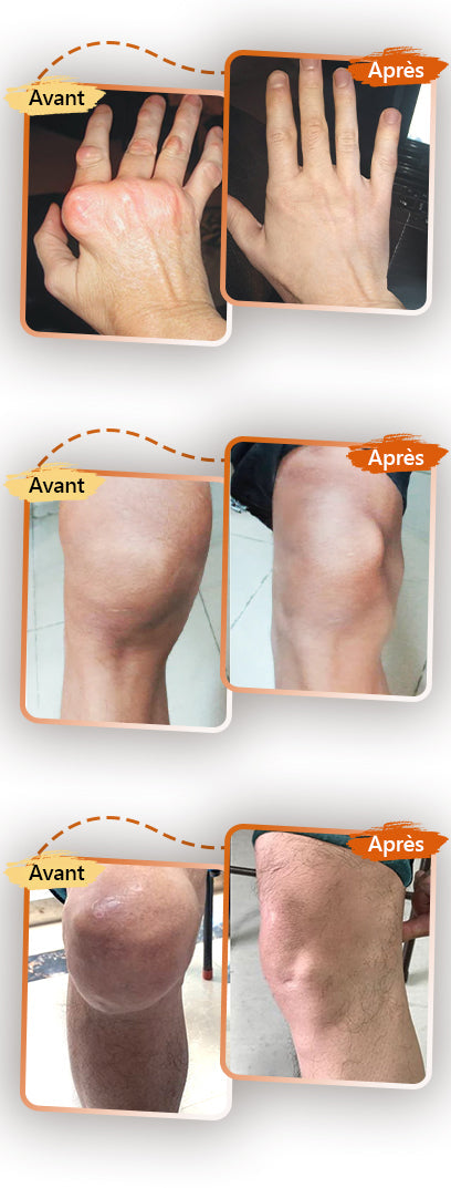 ArthroEase Bee Venom Joint and Bone Arthritis Therapy Cream⭐(Spécialement pour les personnes âgées et recommandé par l'AAOS)