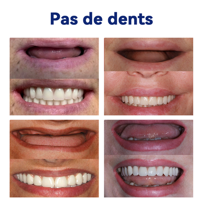 Bikenda™ Ensemble de Règles en Silicone pour Prothèses Dentaires 🚀🚀 (👩‍🔬Conforme CED, Approuvé par des Dentistes Professionnels)