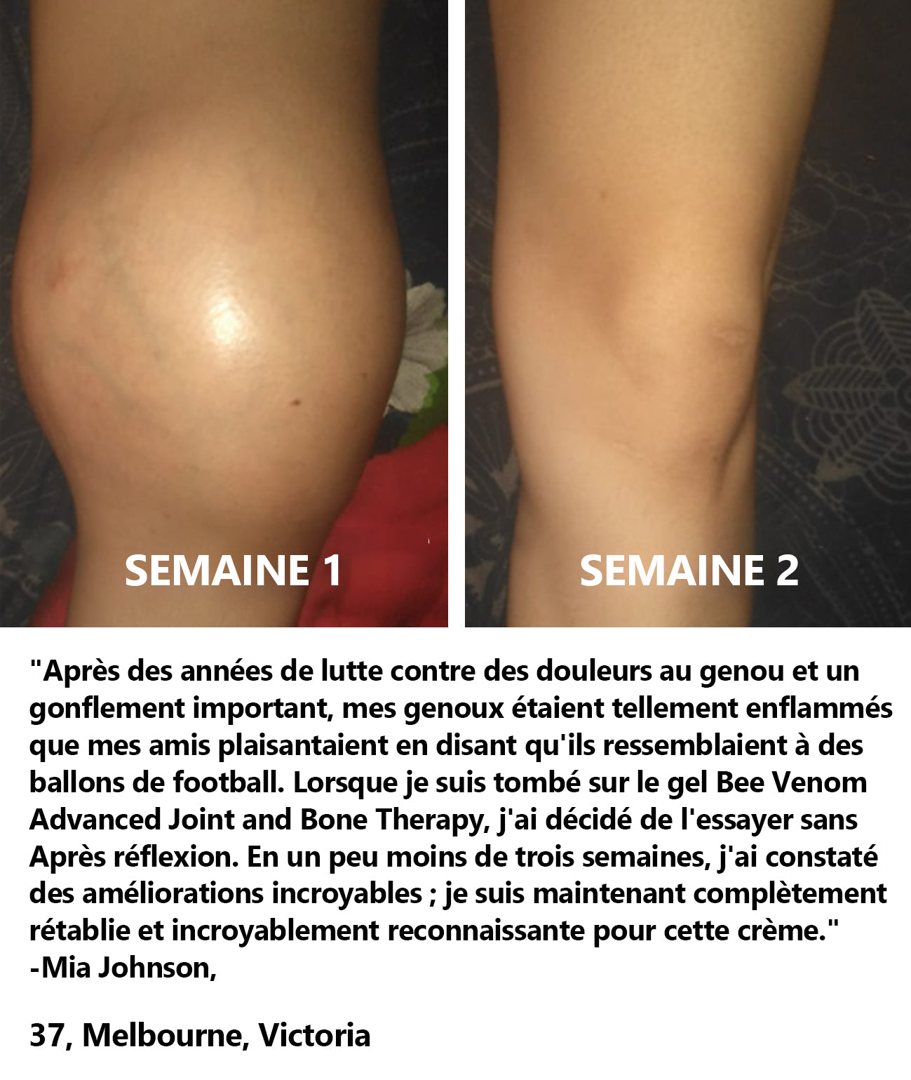 ArthroEase Bee Venom Joint and Bone Arthritis Therapy Cream⭐(Spécialement pour les personnes âgées et recommandé par l'AAOS)