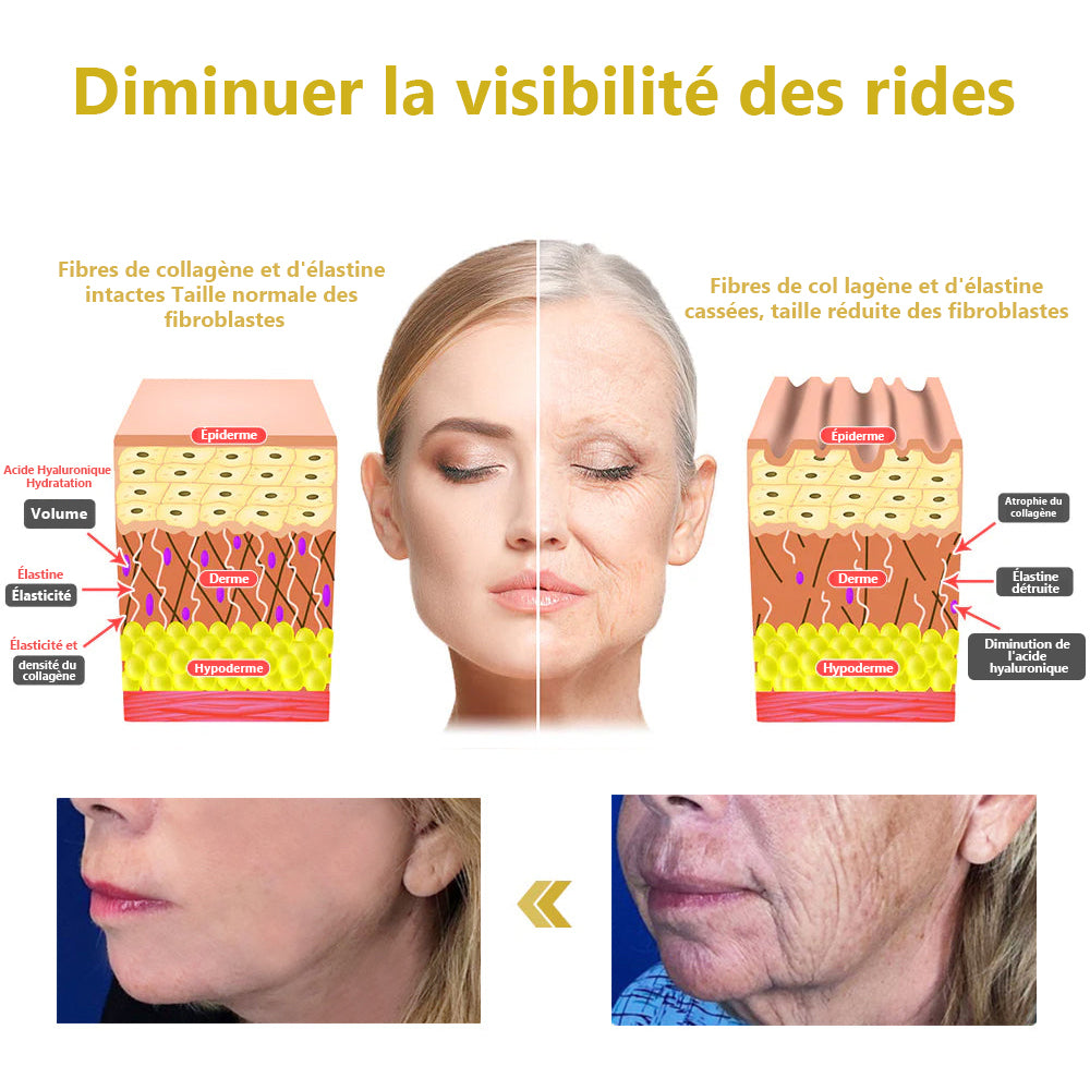 Éliminez les rides et retrouvez l'élasticité de votre peau avec 87 % réduction sur la Fubsta®  Crème Anti-Rides Raffermissante💝