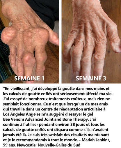 ArthroEase Bee Venom Joint and Bone Arthritis Therapy Cream⭐(Spécialement pour les personnes âgées et recommandé par l'AAOS)