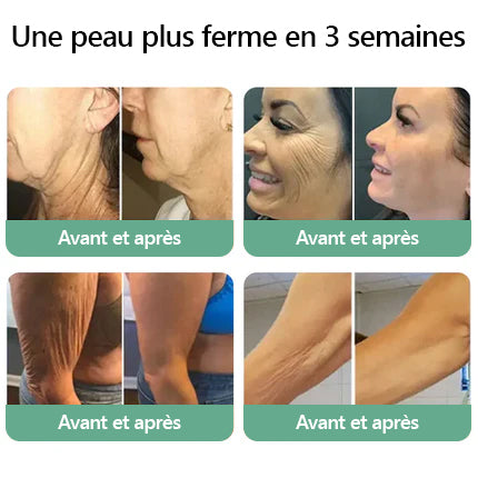 𝐑𝐞𝐜𝐨𝐦𝐦𝐚𝐧𝐝é 𝐩𝐚𝐫 𝐝𝐞𝐬 𝐦é𝐝𝐞𝐜𝐢𝐧𝐬｜✨𝐓𝐋𝐎𝐏𝐀™ 𝐁𝐞𝐚𝐮𝐭𝐲𝐖𝐨𝐦𝐞𝐧 𝐇𝐮𝐢𝐥𝐞 𝐜𝐨𝐫𝐩𝐨𝐫𝐞𝐥𝐥𝐞 𝐥𝐢𝐟𝐭𝐚𝐧𝐭𝐞 𝐚𝐮 𝐜𝐨𝐥𝐥𝐚𝐠è𝐧𝐞 (𝐑é𝐬𝐮𝐥𝐭𝐚𝐭𝐬 𝐯𝐢𝐬𝐢𝐛𝐥𝐞𝐬 𝐞𝐧 𝐬𝐞𝐮𝐥𝐞𝐦𝐞𝐧𝐭 𝟕 𝐣𝐨𝐮𝐫𝐬) 𝐂𝐨𝐧𝐯𝐢𝐞𝐧𝐭 𝐩𝐨𝐮𝐫 : 𝐫𝐞𝐥â𝐜𝐡𝐞𝐦𝐞𝐧𝐭 𝐜𝐮𝐭𝐚𝐧é, 𝐢𝐧𝐟𝐥𝐚𝐦𝐦𝐚𝐭𝐢𝐨𝐧𝐬 𝐝𝐞 𝐥𝐚 𝐩𝐞𝐚𝐮, 𝐯𝐞𝐫𝐫𝐮𝐞𝐬, 𝐯𝐚𝐫𝐢𝐜𝐞𝐬 𝐞𝐭 𝐝𝐢𝐯𝐞𝐫𝐬 𝐩𝐫𝐨𝐛𝐥è𝐦𝐞𝐬 𝐜𝐮𝐭𝐚𝐧é𝐬 🎗️