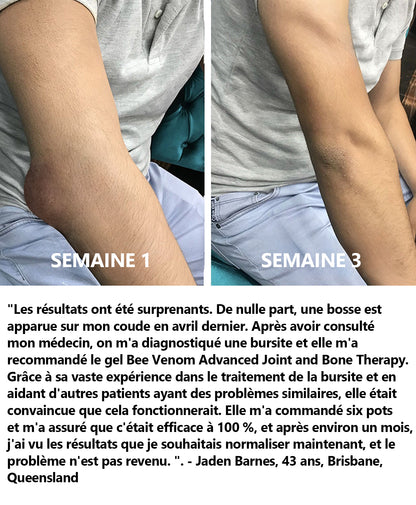 ArthroEase Bee Venom Joint and Bone Arthritis Therapy Cream⭐(Spécialement pour les personnes âgées et recommandé par l'AAOS)