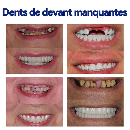 Bikenda™ Ensemble de Règles en Silicone pour Prothèses Dentaires 🚀🚀 (👩‍🔬Conforme CED, Approuvé par des Dentistes Professionnels)