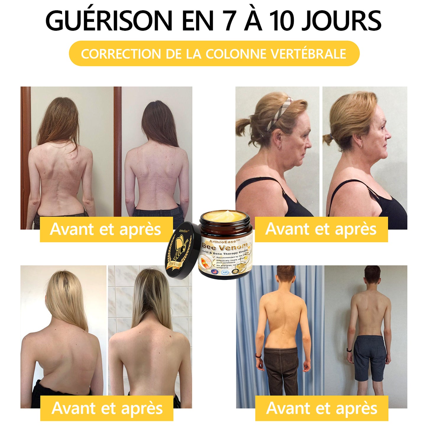 ArthroEase Bee Venom Joint and Bone Arthritis Therapy Cream⭐(Spécialement pour les personnes âgées et recommandé par l'AAOS)