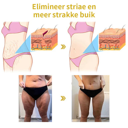 🌸Laatste dag korting: 75% OFF🫧Fubsta® Verstevigende en rimpelverminderende crème: Herstelt de elasticiteit van de huid🌸