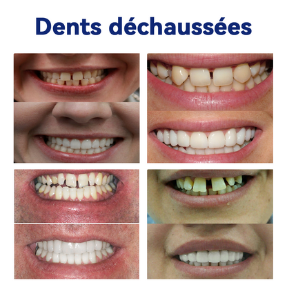 Bikenda™ Ensemble de Règles en Silicone pour Prothèses Dentaires 🚀🚀 (👩‍🔬Conforme CED, Approuvé par des Dentistes Professionnels)