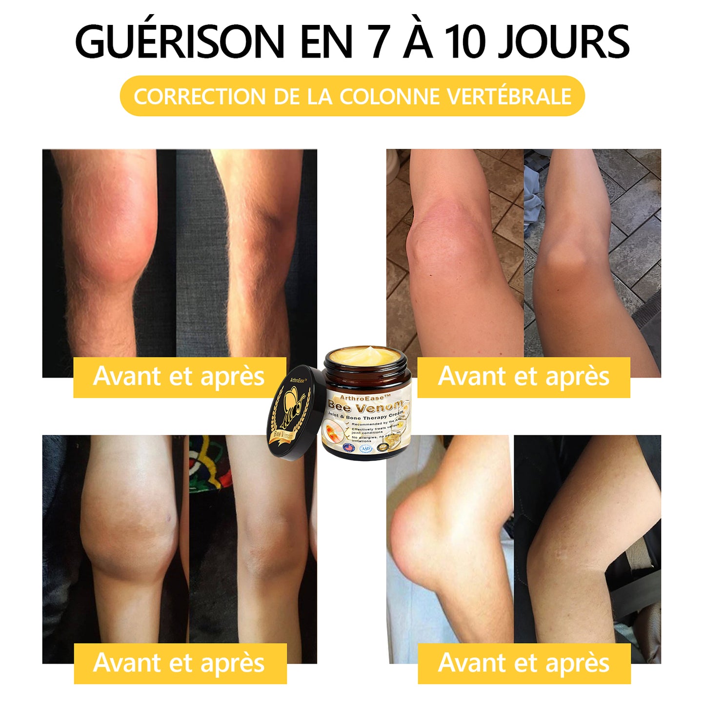 ArthroEase Bee Venom Joint and Bone Arthritis Therapy Cream⭐(Spécialement pour les personnes âgées et recommandé par l'AAOS)