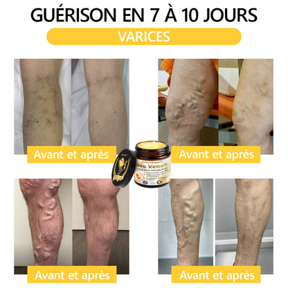 ArthroEase Bee Venom Joint and Bone Arthritis Therapy Cream⭐(Spécialement pour les personnes âgées et recommandé par l'AAOS)