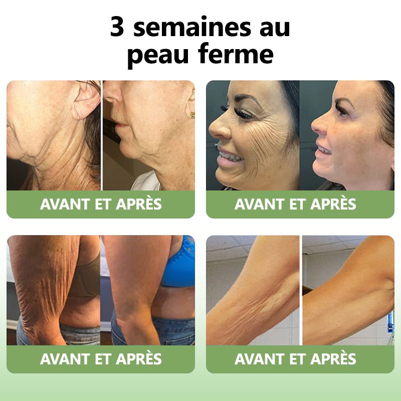 Vente du dernier jour : 70% de réduction sur l'huile raffermissante LEFUN® SkinFirming Rejuvenating Oil💥