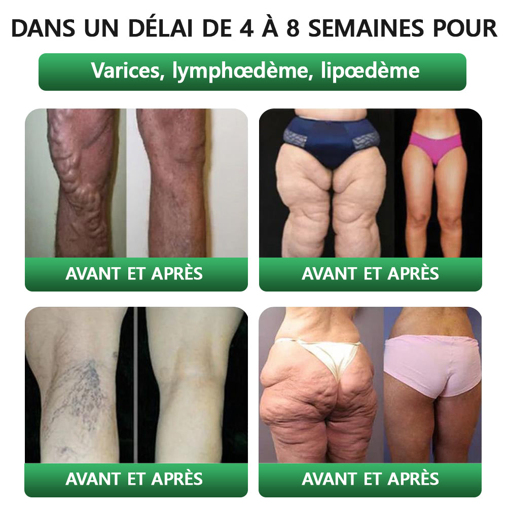 𝐁𝐨𝐮𝐭𝐢𝐪𝐮𝐞 𝐎𝐟𝐟𝐢𝐜𝐢𝐞𝐥𝐥𝐞 | 👩‍⚕️ 𝗟𝗲𝗿𝗰𝗲𝗮® 𝗚𝗟𝗣-𝟭 & 𝗠𝗮𝘁𝗿𝗶𝘅𝘆𝗹 3000 Solution Orale Santé 7 en 1 Body Balance Pour l’obésité, le relâchement cutané, la santé cardiovasculaire, le diabète, l’apnée du sommeil, les problèmes articulaires, etc. 🌐