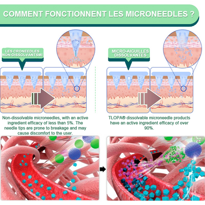 【Dernier jour de promotion -60% 💜】TLOPA® Patch Minceur & Santé NANO MICRONEEDLE Tirzépatide-NIDDK💜（Zéro Douleur, Libération 24h/24 | Perdez 9 kg Rapidement | Réduction de 90 % du Sucre）