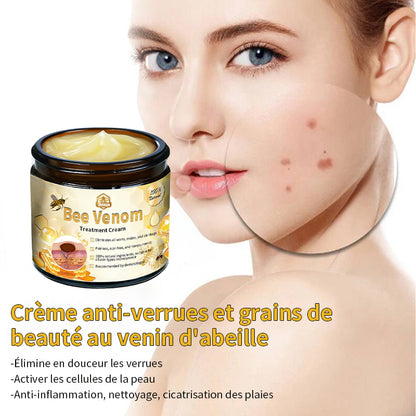 𝑇𝑢𝑟𝑜𝑛𝑢™ Crème de Traitement de la Peau au Venin d'abeille (𝐸𝑆𝐷𝑅 𝑅𝑒𝑐𝑜𝑚𝑚𝑎𝑛𝑑é)✨✨