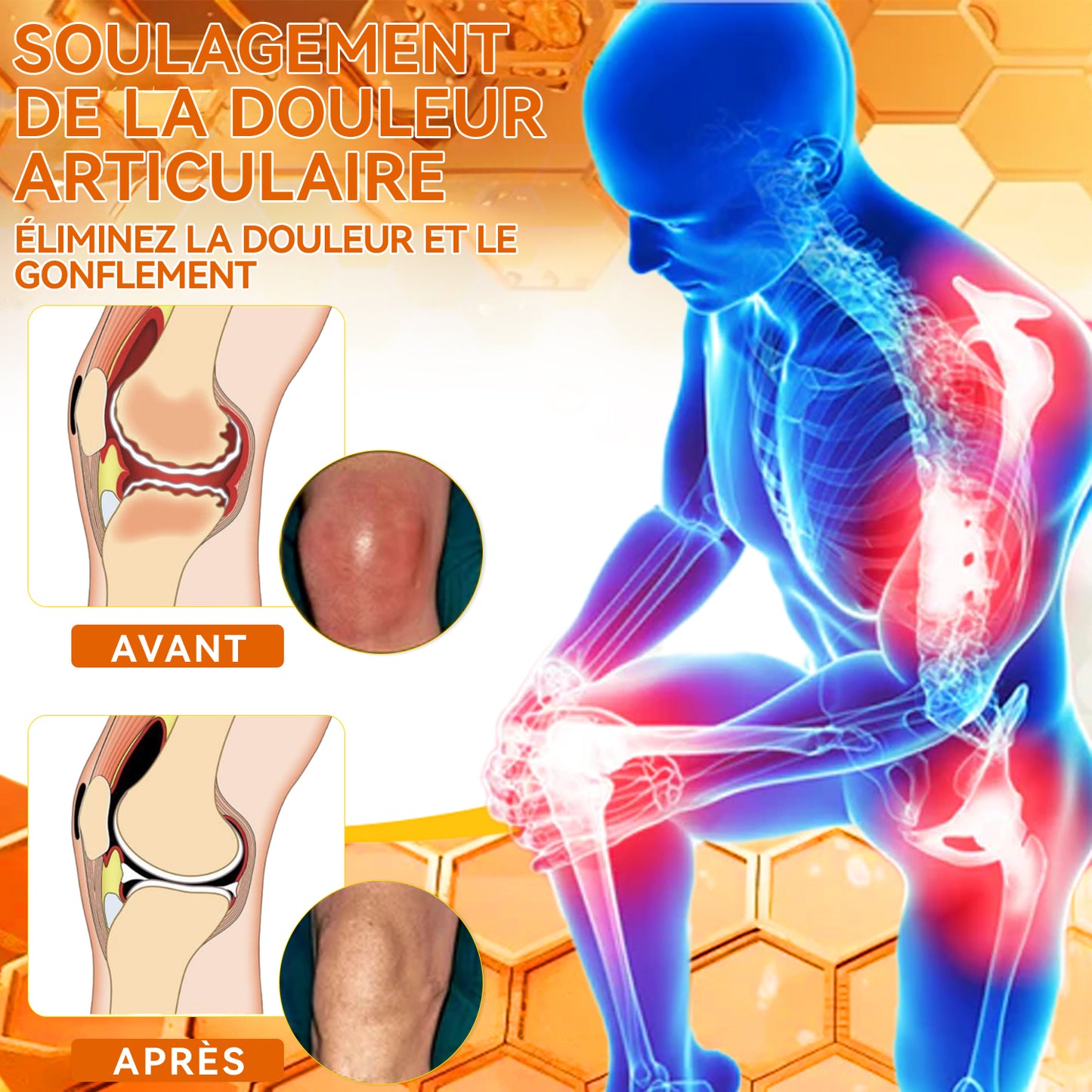 ArthroEase Bee Venom Joint and Bone Arthritis Therapy Cream⭐(Spécialement pour les personnes âgées et recommandé par l'AAOS)